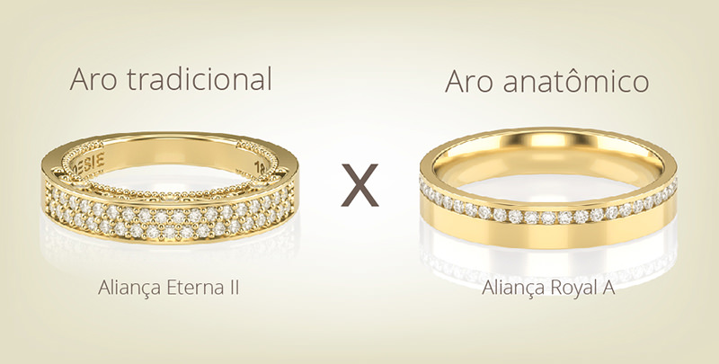 aro-anatomico-tradicional